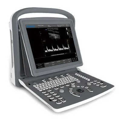 CHISON ECO 2 ultrasound machine