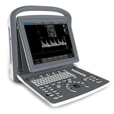 CHISON ECO 2 VET ultrasound machine