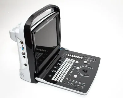 CHISON ECO 3 ultrasound machine