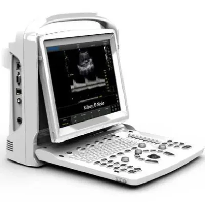 CHISON ECO 3 EXPERT ultrasound machine