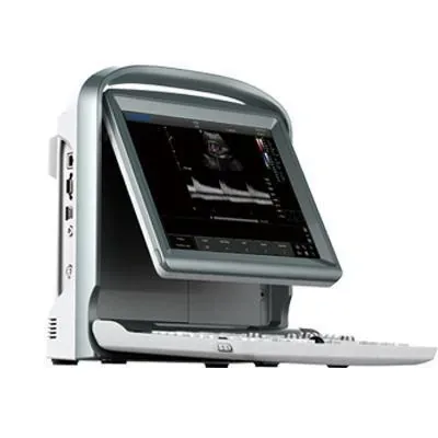 CHISON ECO 5 ultrasound machine
