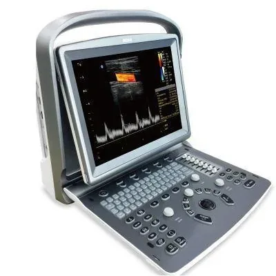 CHISON ECO 6 ultrasound machine