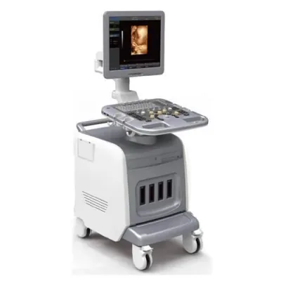 CHISON i3 ultrasound machine