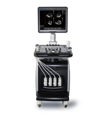 CHISON i8 ultrasound machine