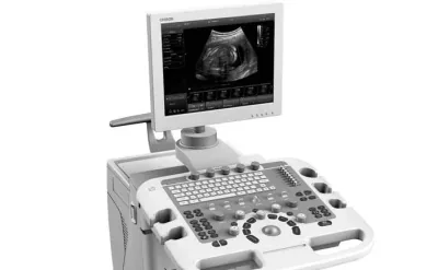 CHISON iVis 20 ultrasound machine
