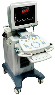 CHISON iVis 60 ultrasound machine