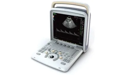 CHISON Q6 ultrasound machine
