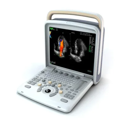 CHISON Q8 ultrasound machine
