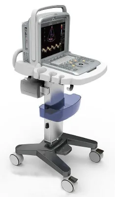 CHISON Q9 ultrasound machine