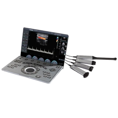 CHISON SonoAir 30 ultrasound machine