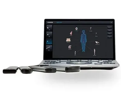 CHISON SonoAir 60 ultrasound machine
