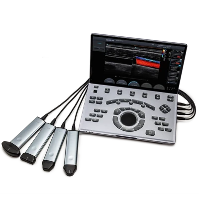 CHISON SonoAir 70 ultrasound machine