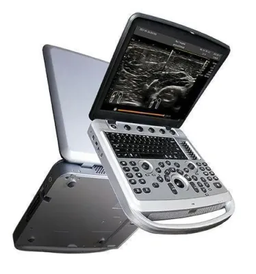 CHISON SonoBook 6 ultrasound machine