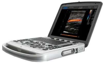 CHISON SonoBook 7 ultrasound machine
