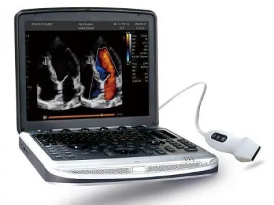 CHISON SonoBook 8 ultrasound machine