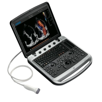 CHISON SonoBook 9 ultrasound machine