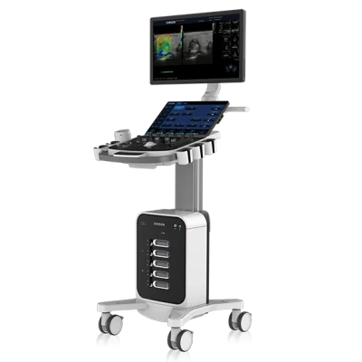 CHISON SonoMax 9 ultrasound machine