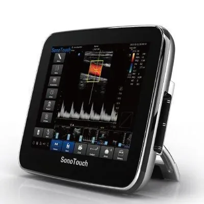 CHISON SonoTouch 30 ultrasound machine