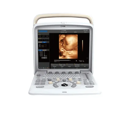 CHISON SonoTouch 60 ultrasound machine