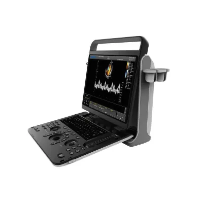 CHISON SonoTouch 60 Pro ultrasound machine