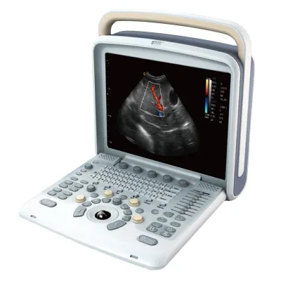 CHISON SonoTouch 80 ultrasound machine