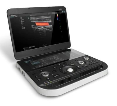 COMEN EP50 ultrasound machine