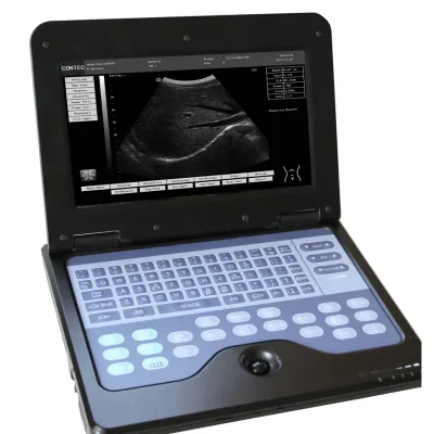 CONTEC CMS 600P ultrasound machine
