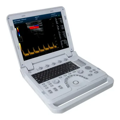 CONTEC CMS1700B ultrasound machine