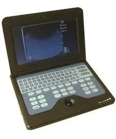 CONTEC CMS600B-2 ultrasound machine