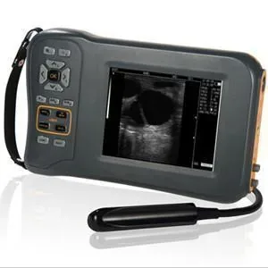 CONTED V5plus ultrasound machine