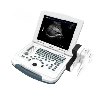 DAWEI DW-580 ultrasound machine