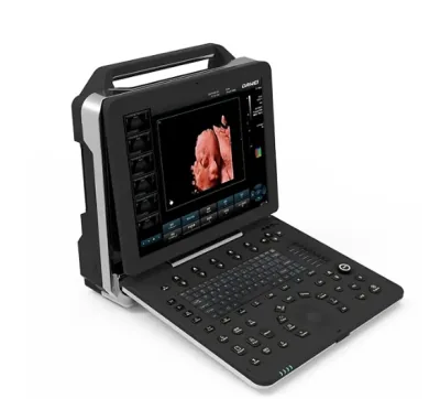 DAWEI DW-P50 (P5PRO) ultrasound machine