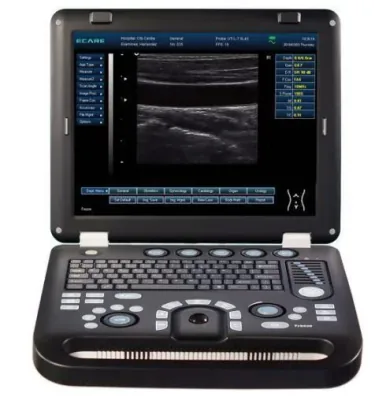 ECARE E50A ultrasound machine