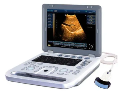 ECARE EC50A ultrasound machine