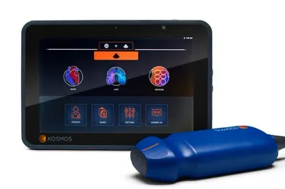 ECHONOUS KOSMOS ultrasound machine