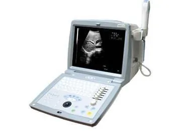 ECOSON 800V ultrasound machine