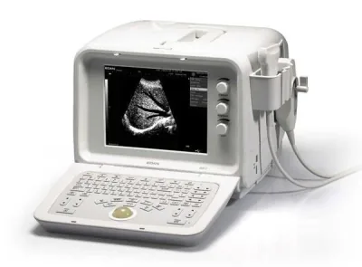 EDAN D3 ultrasound machine
