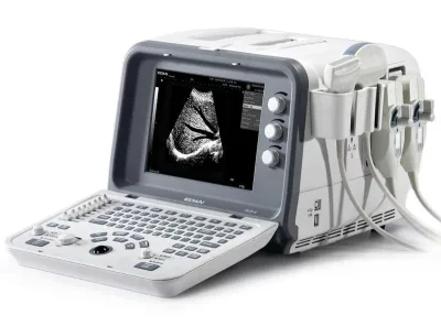 EDAN D6 ultrasound machine