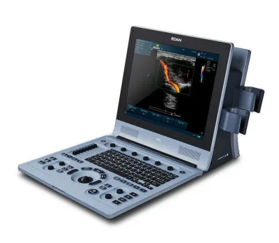 EDAN U60 ultrasound machine