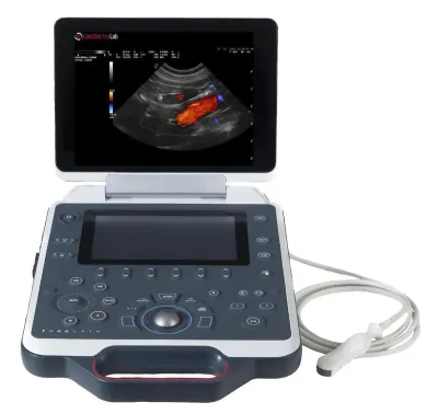 ESAOTE MyLab Delta ultrasound machine