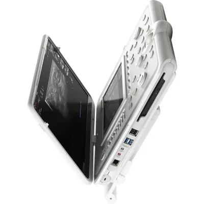 ESAOTE MyLab Omega ultrasound machine