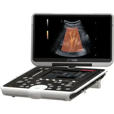 ESAOTE MyLab Omega eXP ultrasound machine