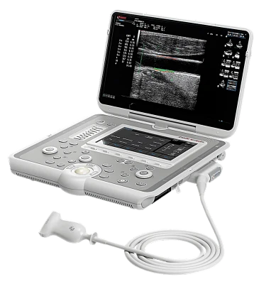 ESAOTE MyLab Sigma Elite ultrasound machine
