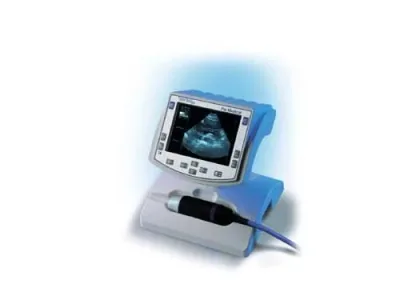 ESAOTE Tringa ultrasound machine