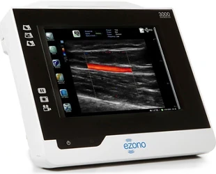 EZONO 3000 ultrasound machine