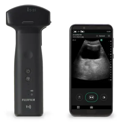 FUJIFILM Iviz ultrasound machine