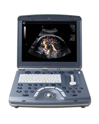 GE Voluson I ultrasound machine
