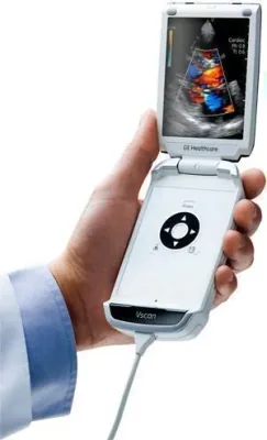 GE Vscan ultrasound machine