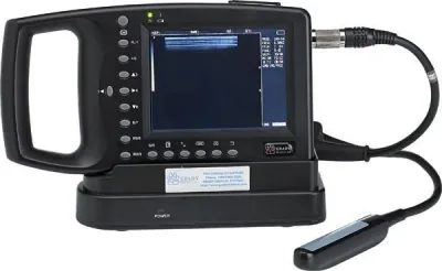 GRADY 310V ultrasound machine