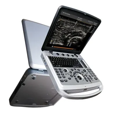 GRADY DUS 4300 ultrasound machine